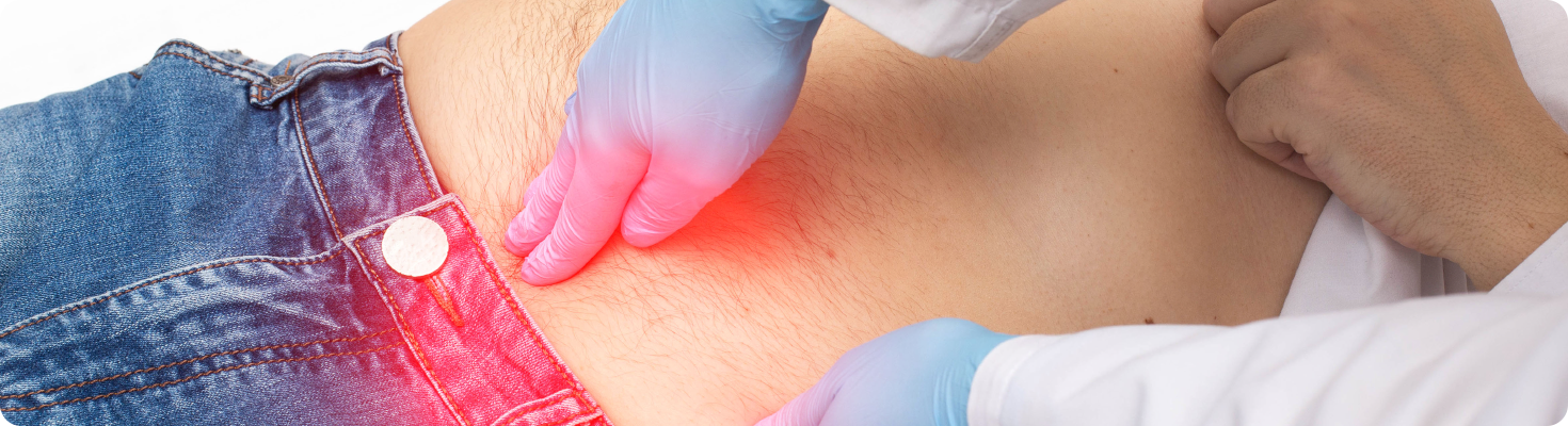 Hernia Surgery in Singapore- Effective Treatment for a Common Condition