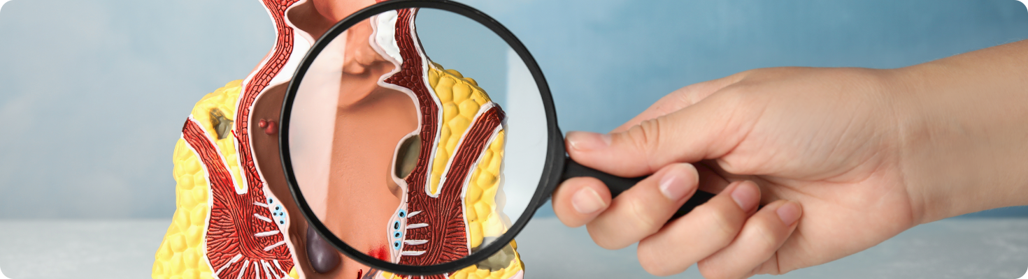 Your Trusted Partner in Colorectal Health